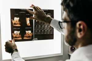 why bone recovery important for lifelong health